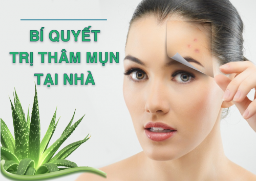 Bí quyết trị thâm mụn tại nhà